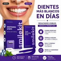 Comparación antes y después con Serulox White Strips